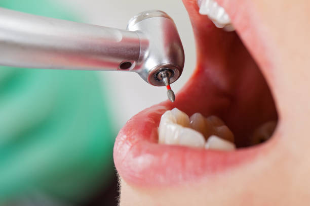Best Emergency Dental Care for Broken or Chipped Teeth in Highland Lakes, AL